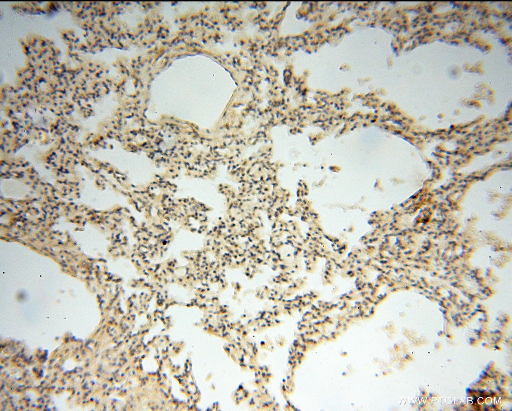 IHC staining of human lung using 14755-1-AP