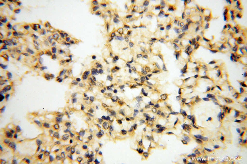 Immunohistochemistry (IHC) staining of human lung tissue using ACAT2 Polyclonal antibody (14755-1-AP)