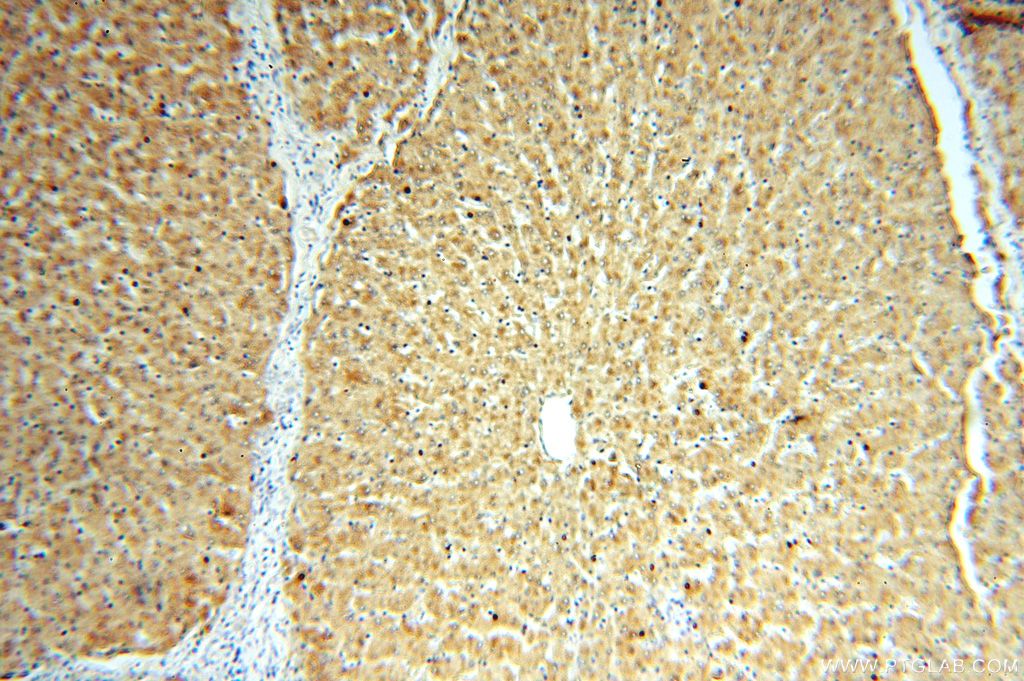 Immunohistochemistry (IHC) staining of human liver tissue using ACAT2 Polyclonal antibody (14755-1-AP)