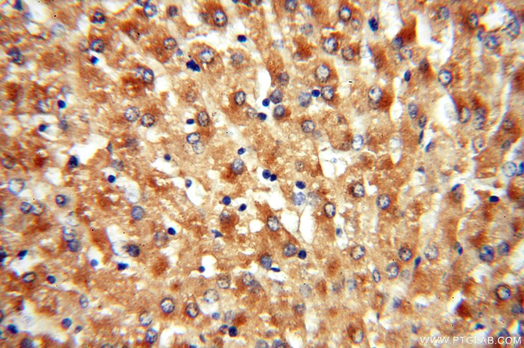 Immunohistochemistry (IHC) staining of human liver tissue using ACAT2 Polyclonal antibody (14755-1-AP)