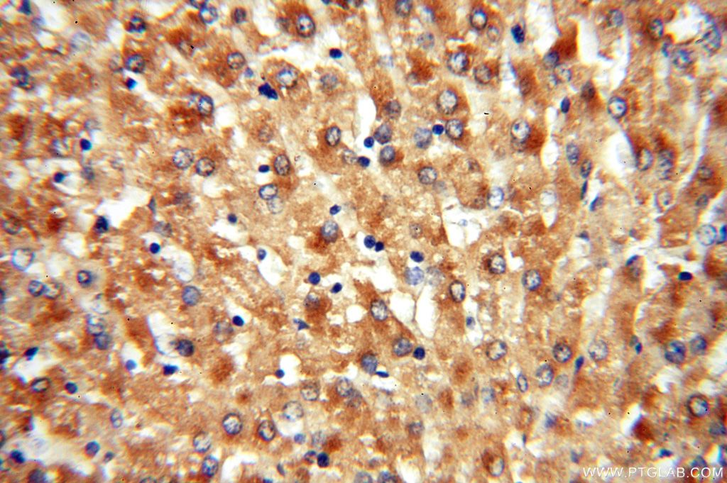 IHC staining of human liver using 14755-1-AP