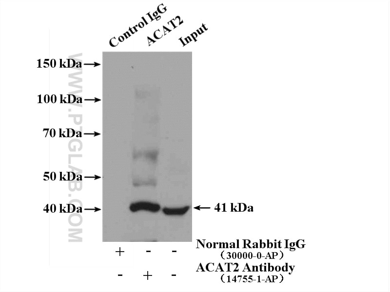 Immunoprecipitation (IP) experiment of mouse liver tissue using ACAT2 Polyclonal antibody (14755-1-AP)