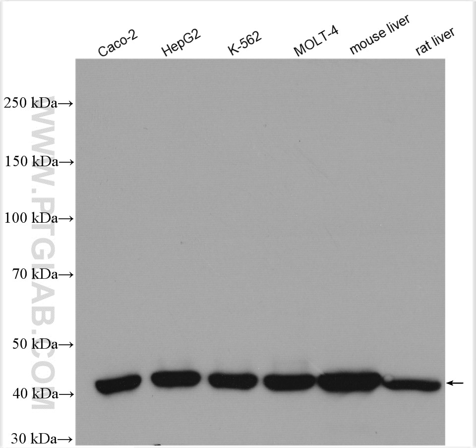 Western Blot (WB) analysis of various lysates using ACAT2 Polyclonal antibody (14755-1-AP)