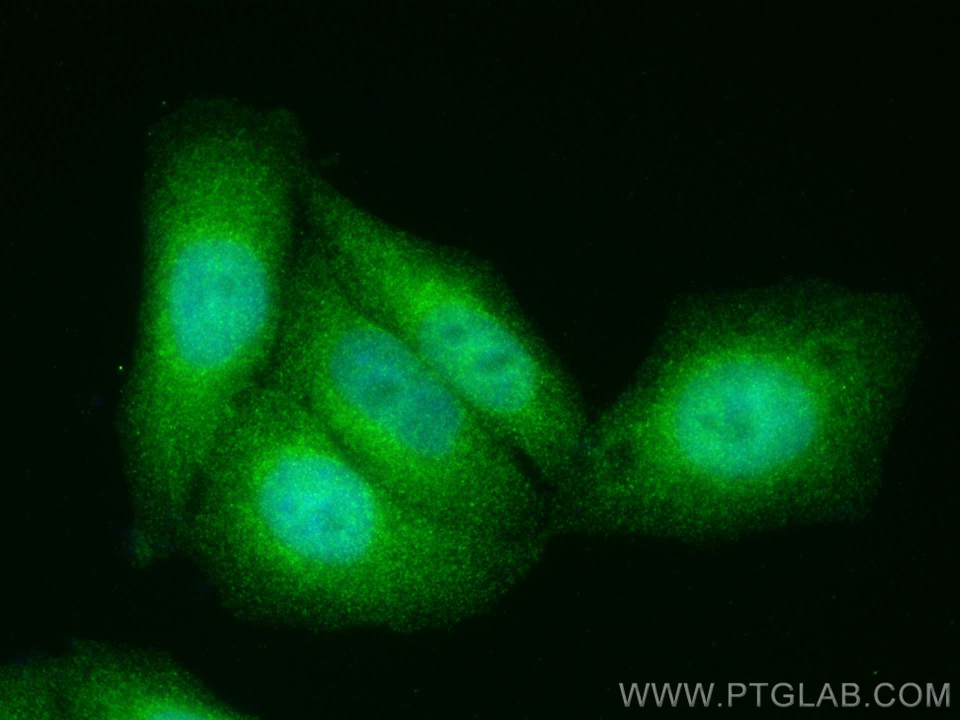 Immunofluorescence (IF) / fluorescent staining of HepG2 cells using ACAT2 Monoclonal antibody (68005-1-Ig)