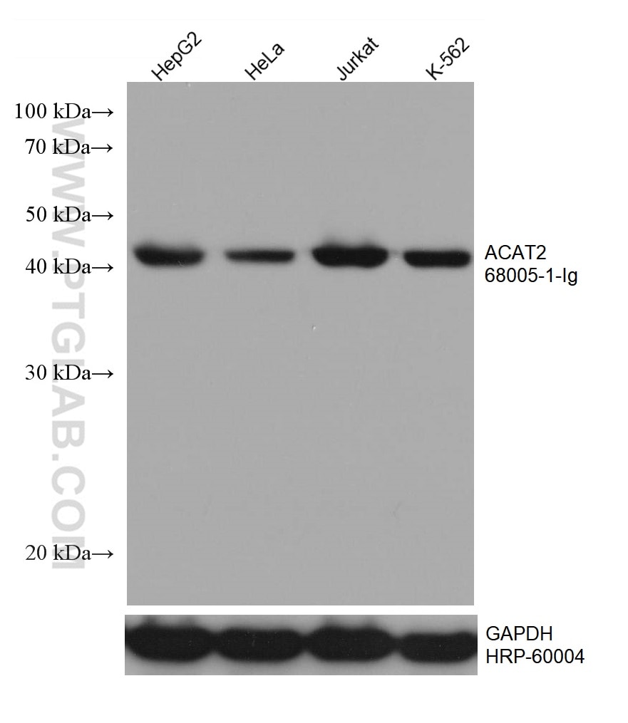 Western Blot (WB) analysis of various lysates using ACAT2 Monoclonal antibody (68005-1-Ig)