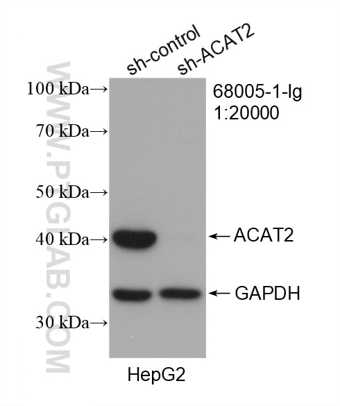 Western Blot (WB) analysis of HepG2 cells using ACAT2 Monoclonal antibody (68005-1-Ig)
