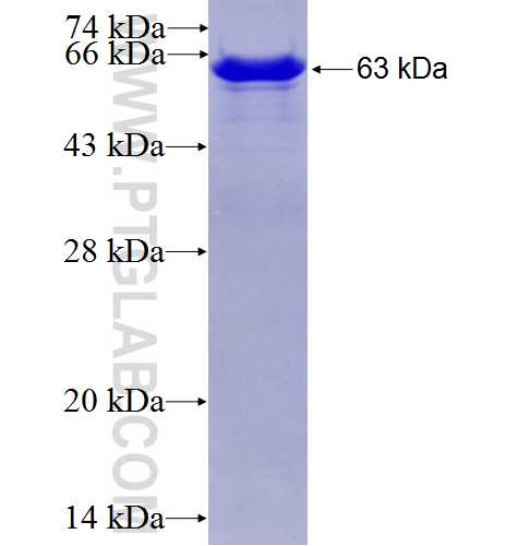 ACAT2 fusion protein Ag6503 SDS-PAGE