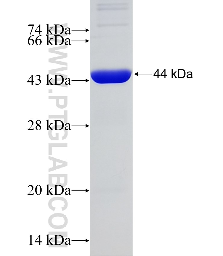 ACAT2 fusion protein Ag6596 SDS-PAGE