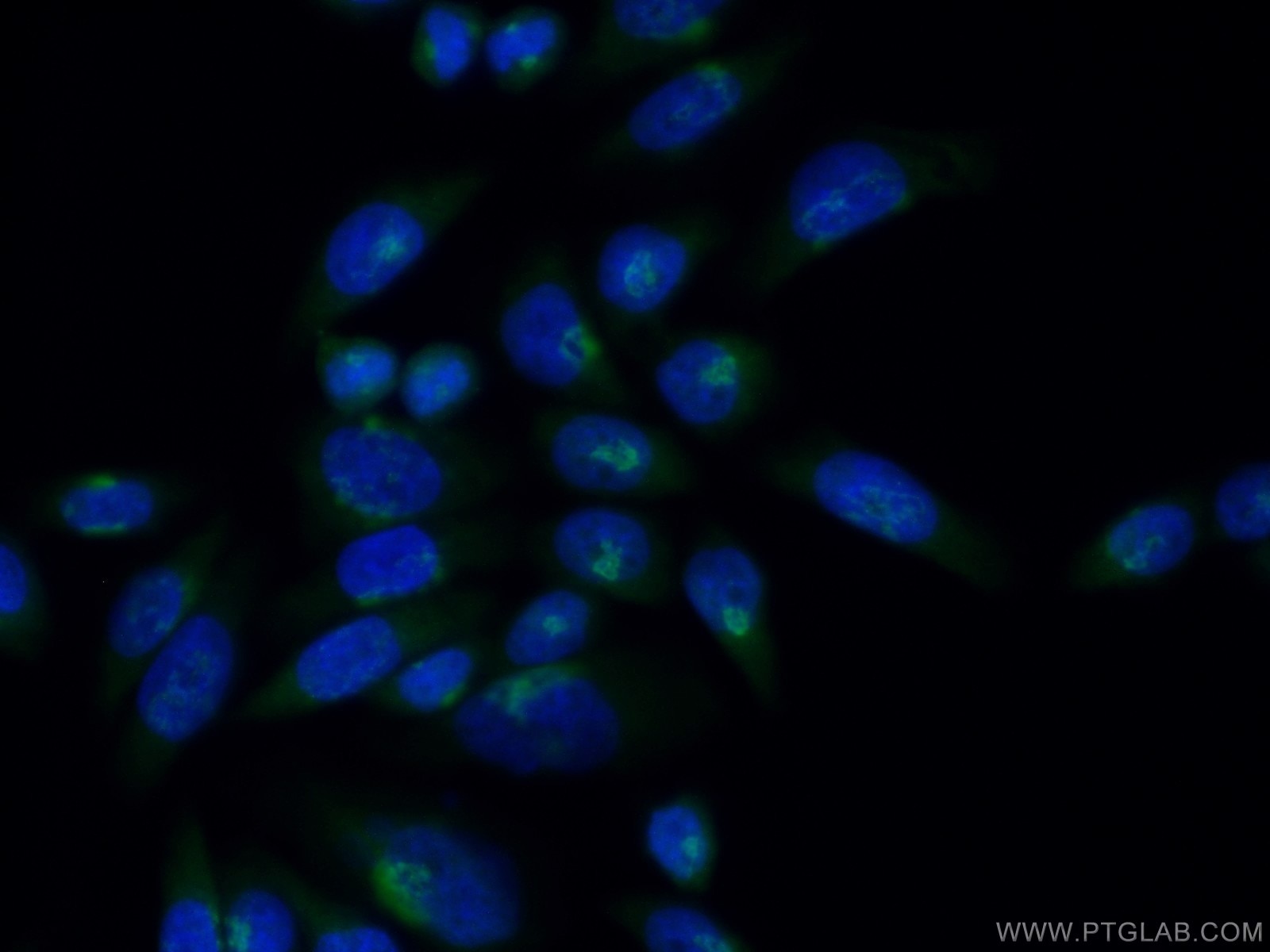 Immunofluorescence (IF) / fluorescent staining of HeLa cells using ACBD3 Polyclonal antibody (14096-1-AP)