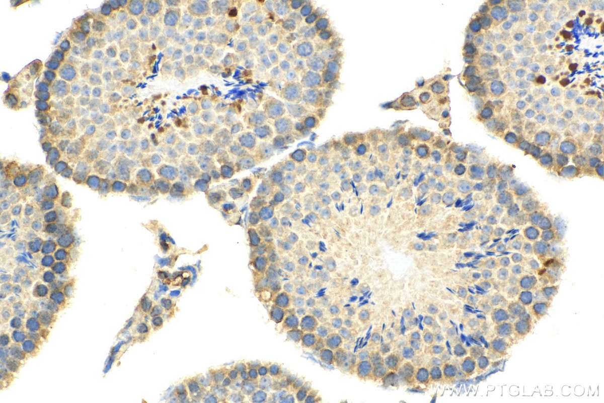 Immunohistochemistry (IHC) staining of mouse testis tissue using ACBD3 Polyclonal antibody (14096-1-AP)