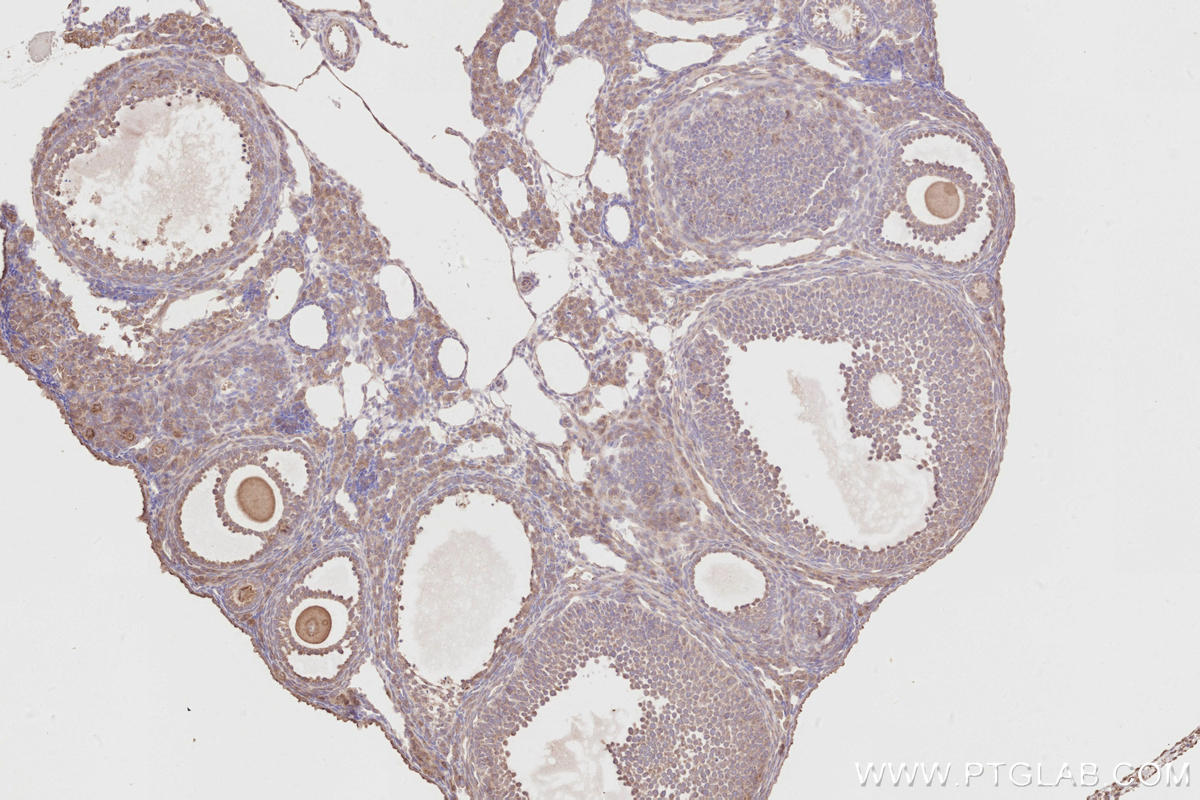 Immunohistochemistry (IHC) staining of mouse ovary tissue using ACBD3 Polyclonal antibody (14096-1-AP)