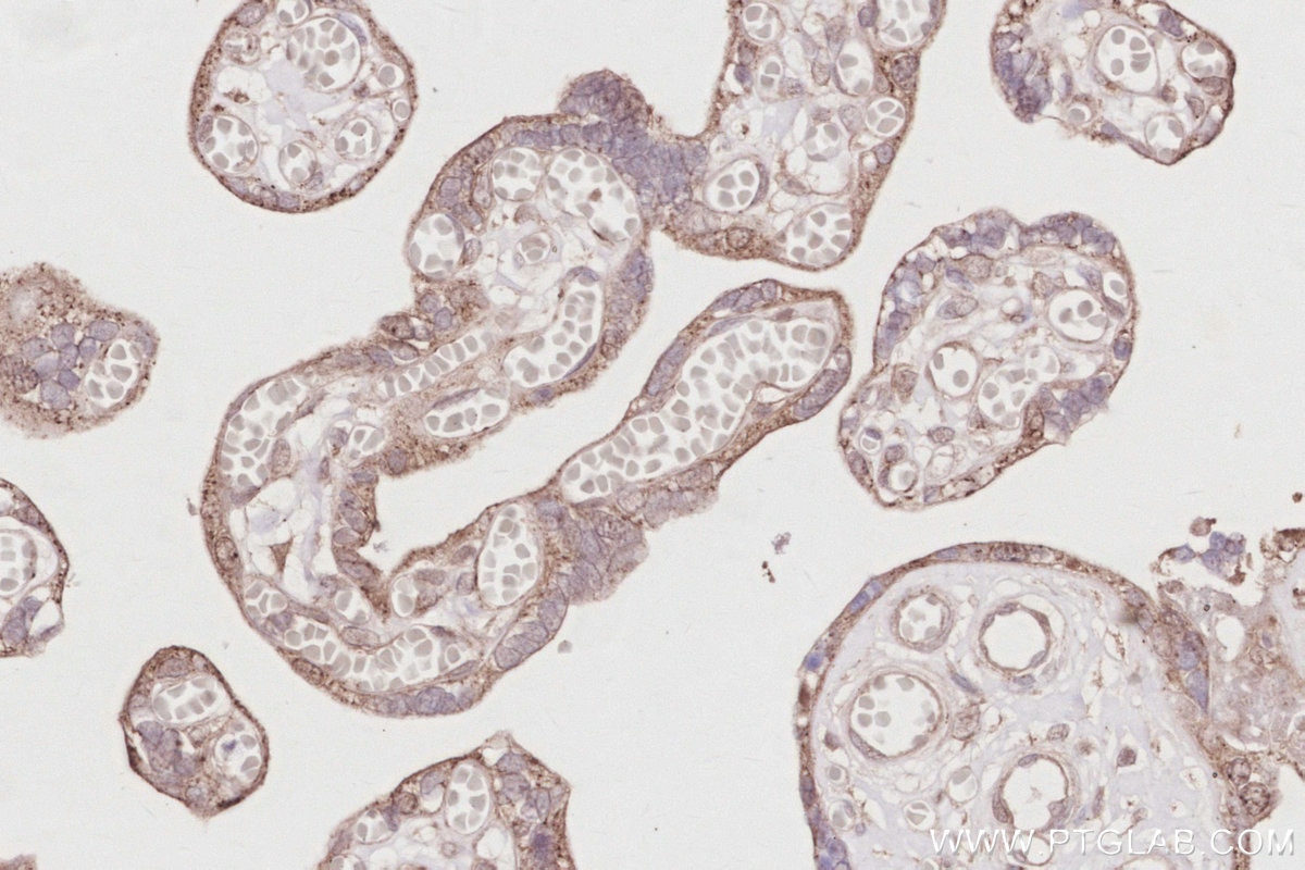 Immunohistochemistry (IHC) staining of human placenta tissue using ACBD3 Polyclonal antibody (14096-1-AP)