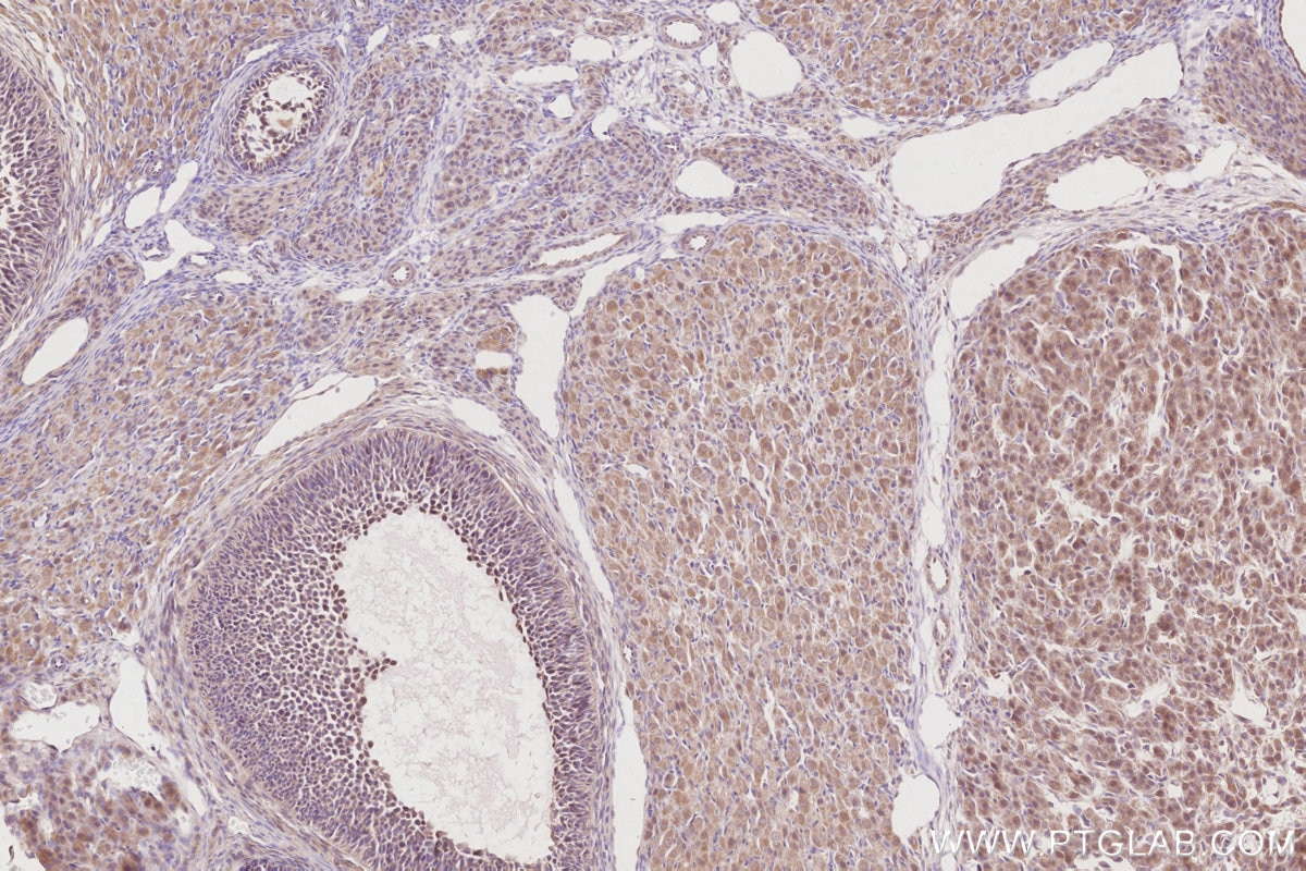 Immunohistochemistry (IHC) staining of rat ovary tissue using ACBD3 Polyclonal antibody (14096-1-AP)
