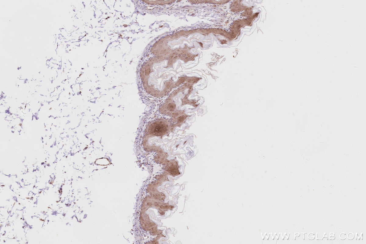 Immunohistochemistry (IHC) staining of mouse stomach tissue using ACBD3 Polyclonal antibody (14096-1-AP)