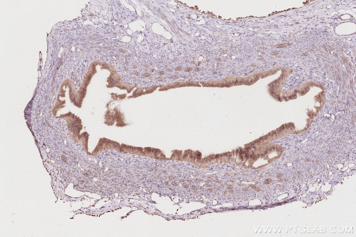 Immunohistochemistry (IHC) staining of rat ovary tissue using ACBD3 Polyclonal antibody (14096-1-AP)