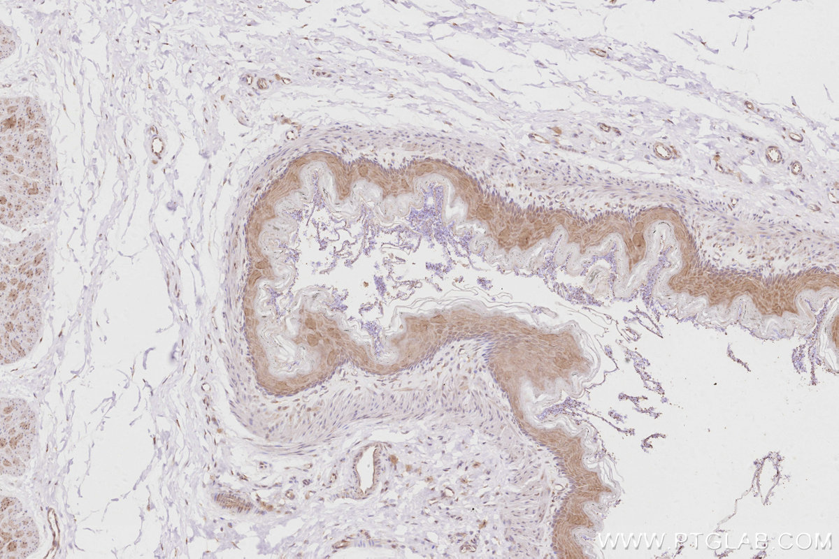 Immunohistochemistry (IHC) staining of rat stomach tissue using ACBD3 Polyclonal antibody (14096-1-AP)