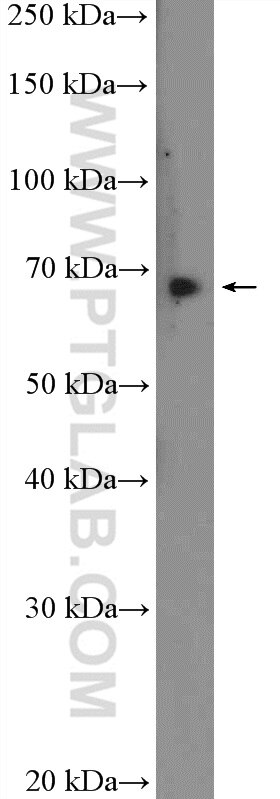 WB analysis of mouse testis using 14096-1-AP