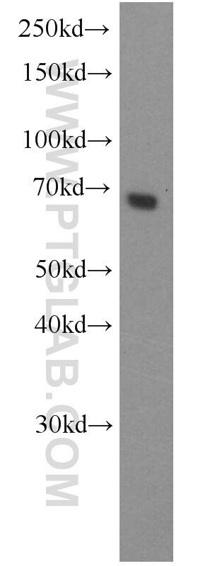 Western Blot (WB) analysis of HeLa cells using ACBD3 Polyclonal antibody (14096-1-AP)