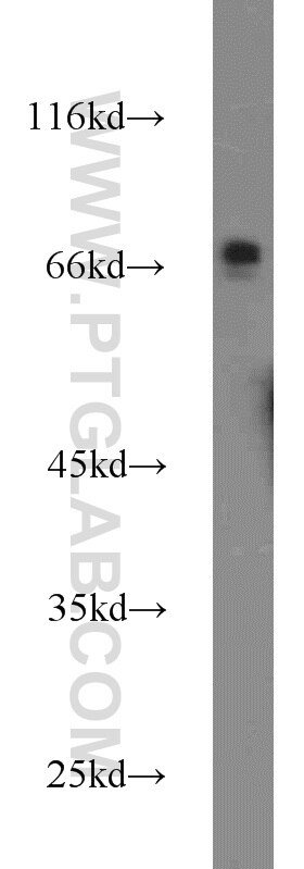 Western Blot (WB) analysis of A2780 cells using ACBD3 Polyclonal antibody (14096-1-AP)