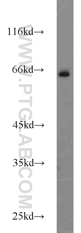 Western Blot (WB) analysis of Jurkat cells using ACBD3 Polyclonal antibody (14096-1-AP)