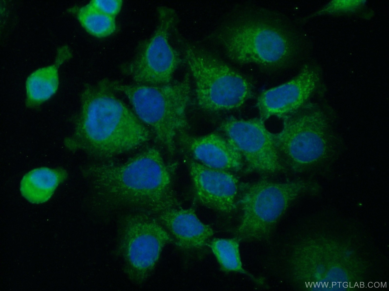 Immunofluorescence (IF) / fluorescent staining of MCF-7 cells using ACBD4 Polyclonal antibody (20941-1-AP)