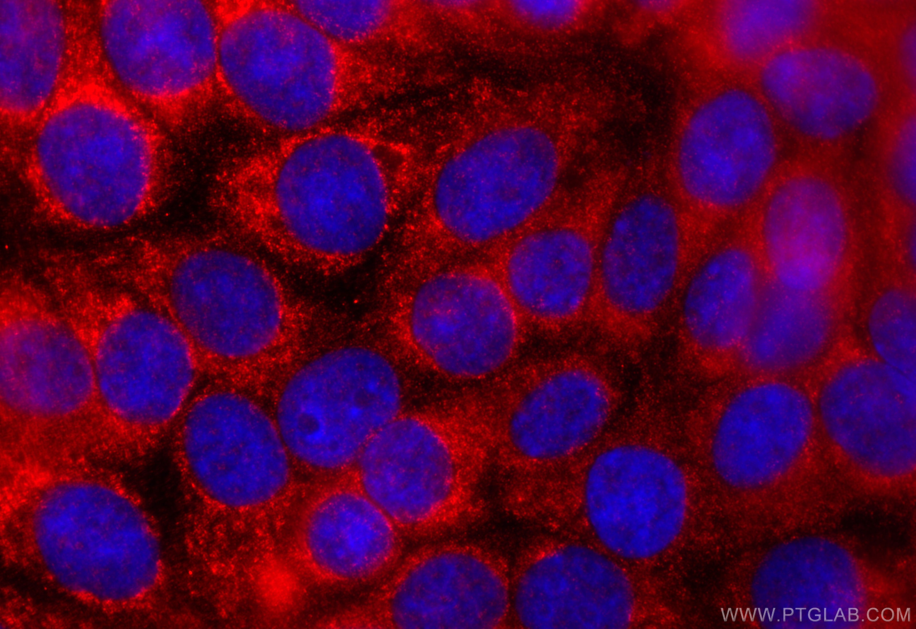 Immunofluorescence (IF) / fluorescent staining of MCF-7 cells using ACBD4 Polyclonal antibody (20941-1-AP)