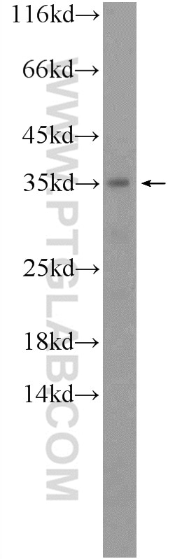 Western Blot (WB) analysis of human kidney tissue using ACBD4 Polyclonal antibody (20941-1-AP)