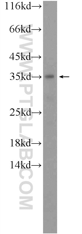 WB analysis of human kidney using 20941-1-AP