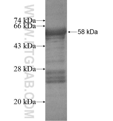 ACBD4 fusion protein Ag15045 SDS-PAGE