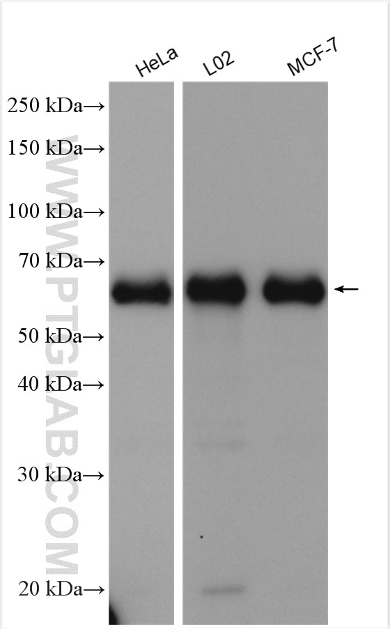Western Blot (WB) analysis of various lysates using ACBD5 Polyclonal antibody (21080-1-AP)