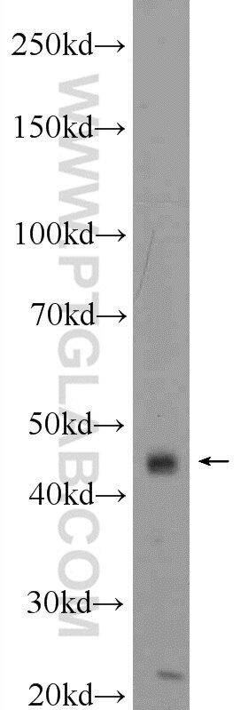 Western Blot (WB) analysis of mouse skeletal muscle tissue using ACBD5 Polyclonal antibody (21080-1-AP)