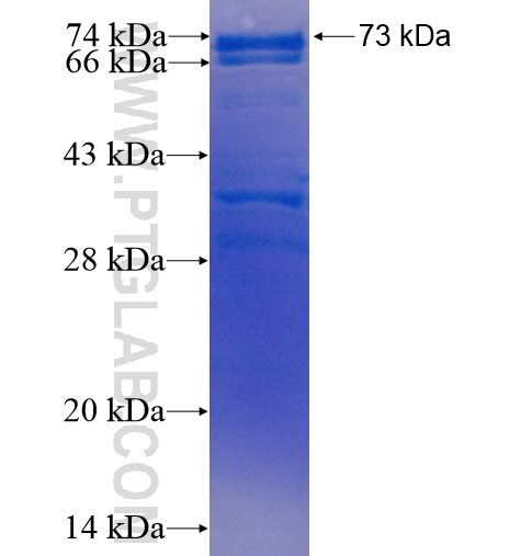 ACBD5 fusion protein Ag15287 SDS-PAGE