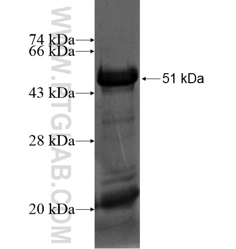 ACBD5 fusion protein Ag15511 SDS-PAGE