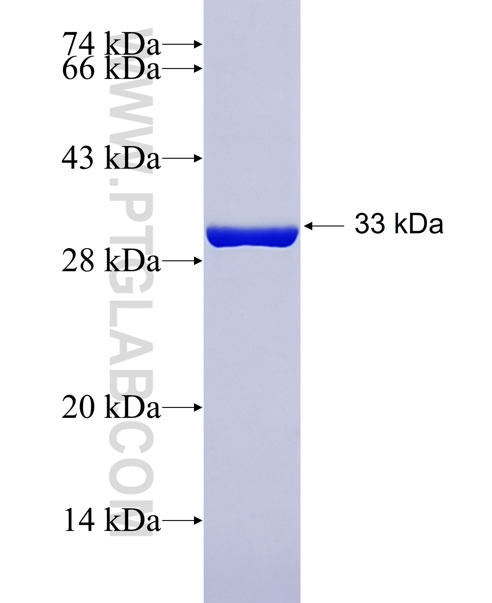 ACBD7 fusion protein Ag40829 SDS-PAGE