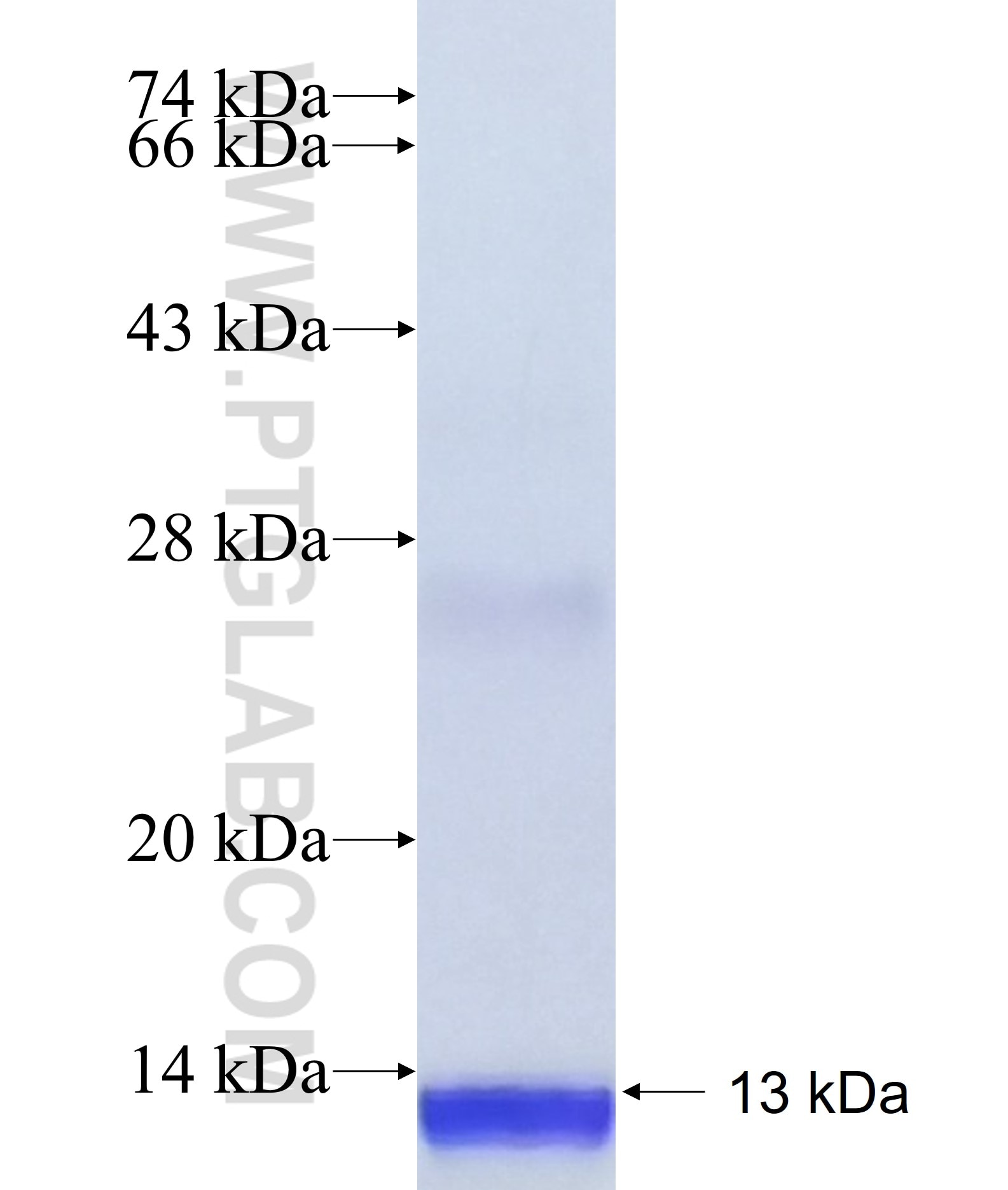ACBD7 fusion protein Ag40850 SDS-PAGE