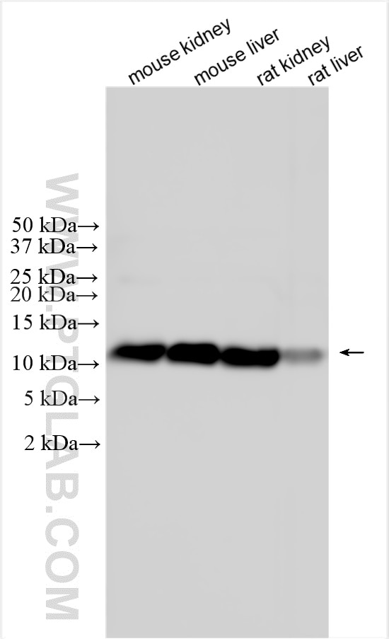 WB analysis using 32990-1-AP Western Blot (WB) analysis of various lysates using ACBP/DBI Polyclonal antibody (32990-1-AP)