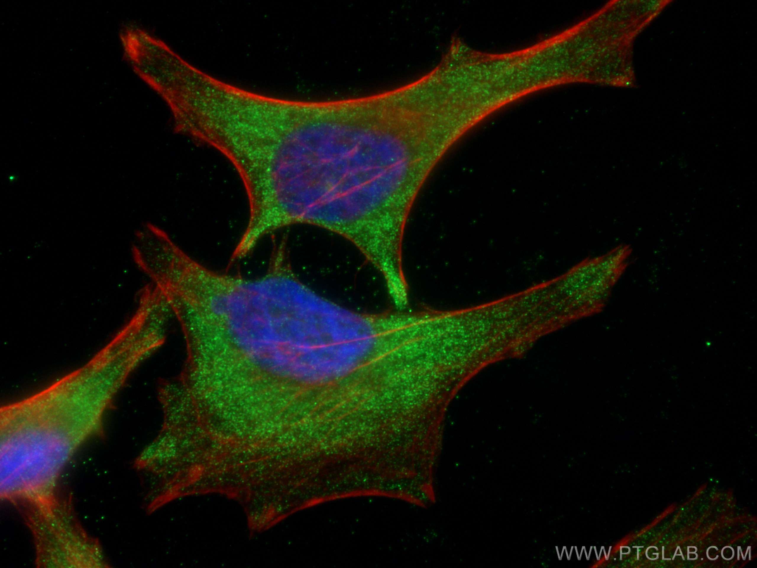 Immunofluorescence (IF) / fluorescent staining of HeLa cells using ACC1 Monoclonal antibody (67373-1-Ig)