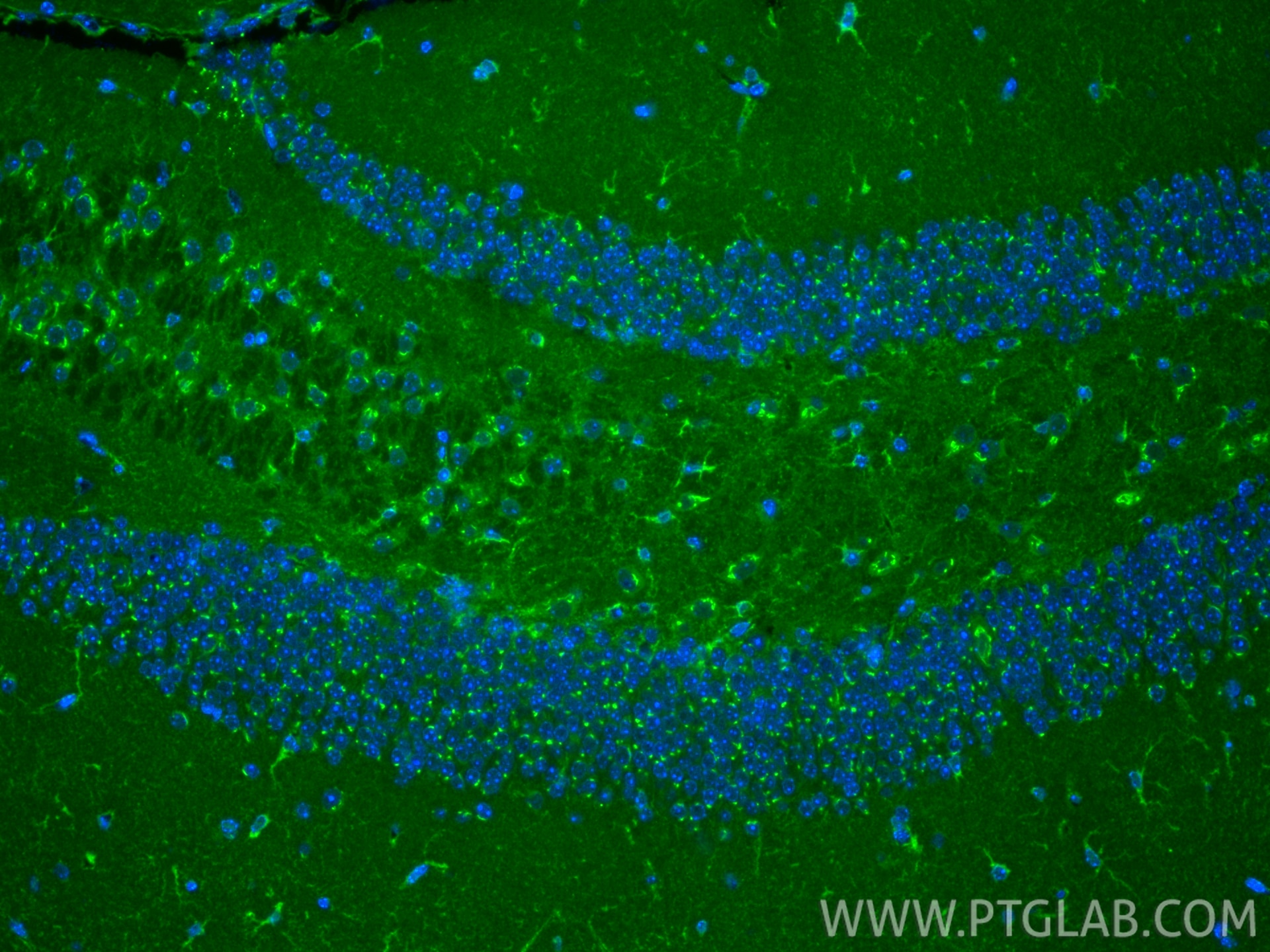 IF Staining of mouse brain using 81656-1-RR Immunofluorescence (IF) / fluorescent staining of mouse brain tissue using ACC1 Recombinant monoclonal antibody (81656-1-RR)