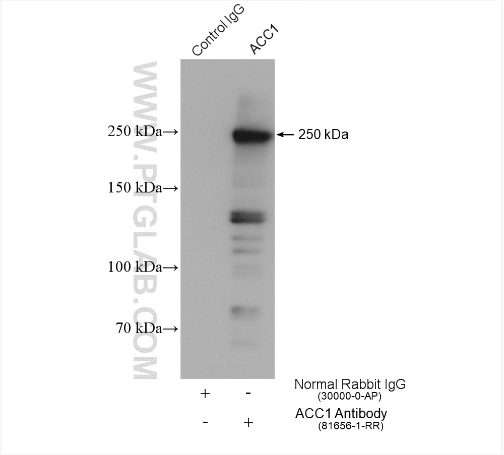 Immunoprecipitation (IP) experiment of HepG2 cells using ACC1 Recombinant antibody (81656-1-RR)