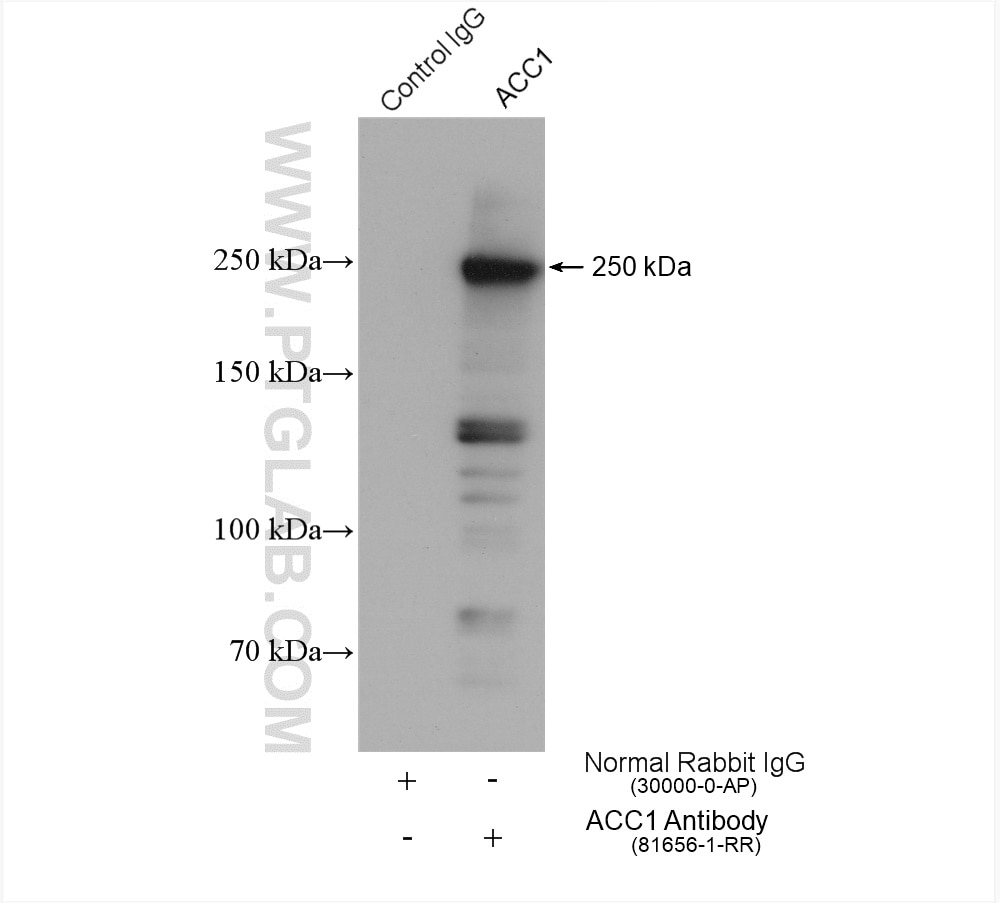 IP experiment of HepG2 using 81656-1-RR