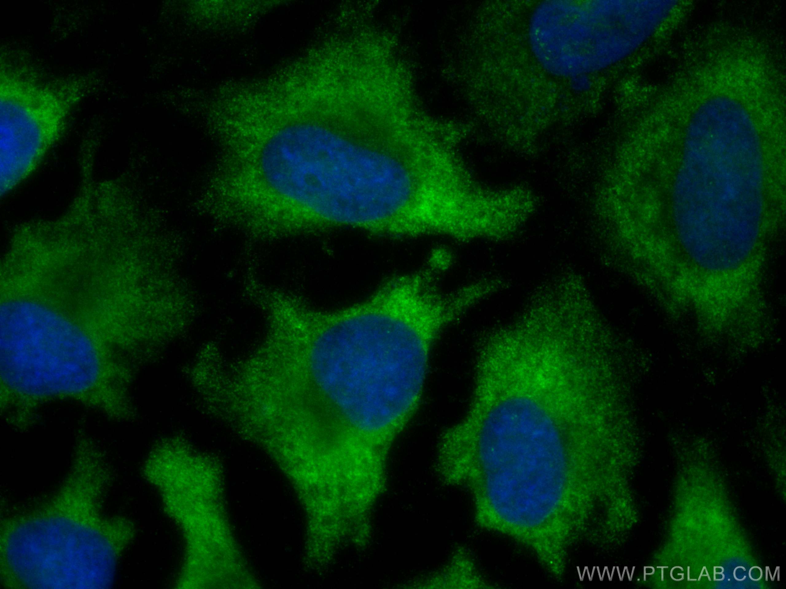 Immunofluorescence (IF) / fluorescent staining of HeLa cells using CoraLite® Plus 488-conjugated ACC1 Monoclonal anti (CL488-67373)