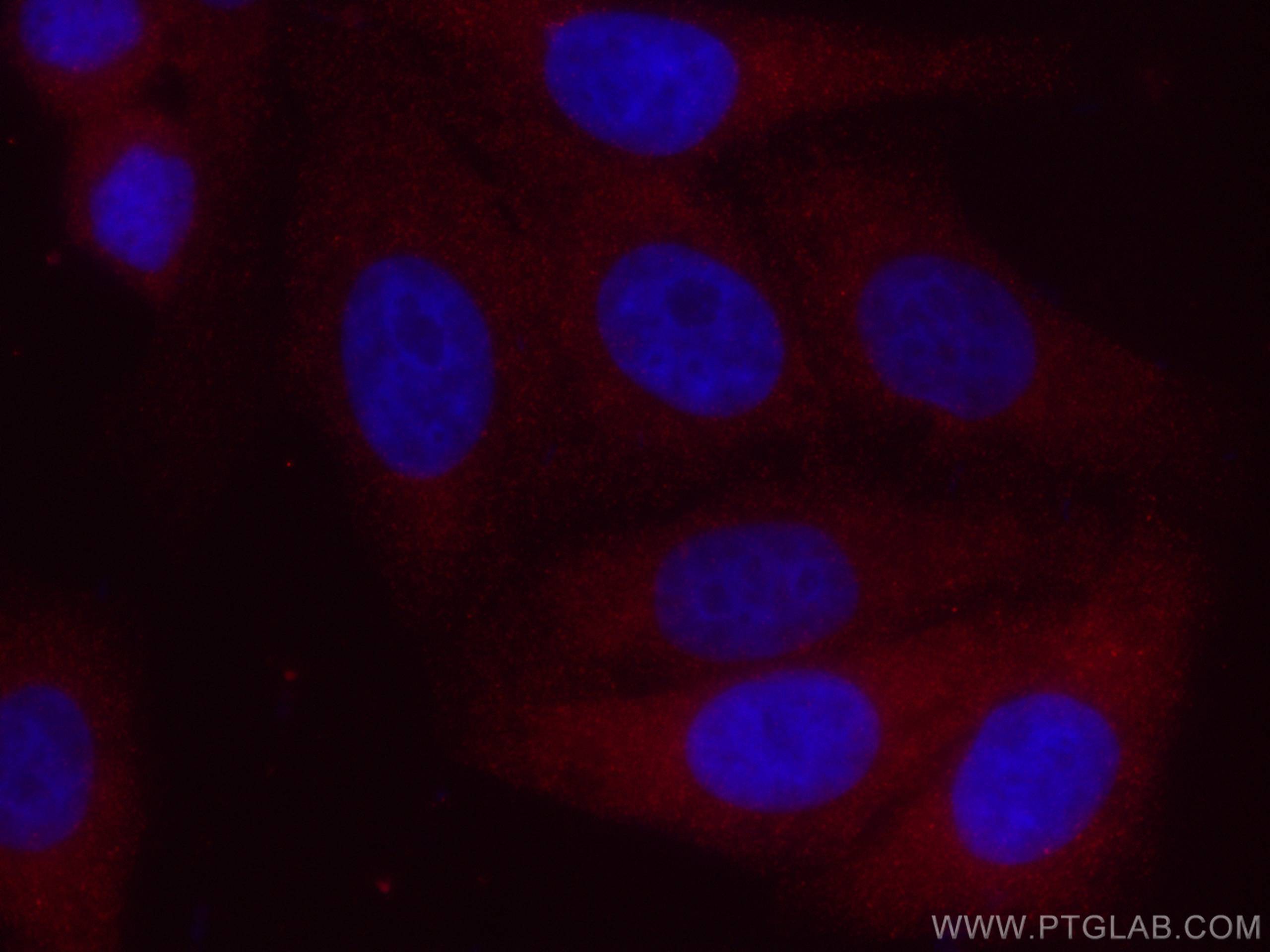 Immunofluorescence (IF) / fluorescent staining of HepG2 cells using CoraLite®594-conjugated ACC1 Monoclonal antibody (CL594-67373)