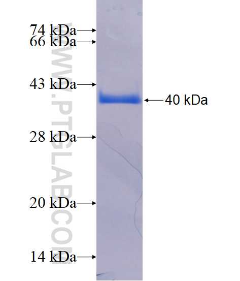 ACC fusion protein Ag16452 SDS-PAGE