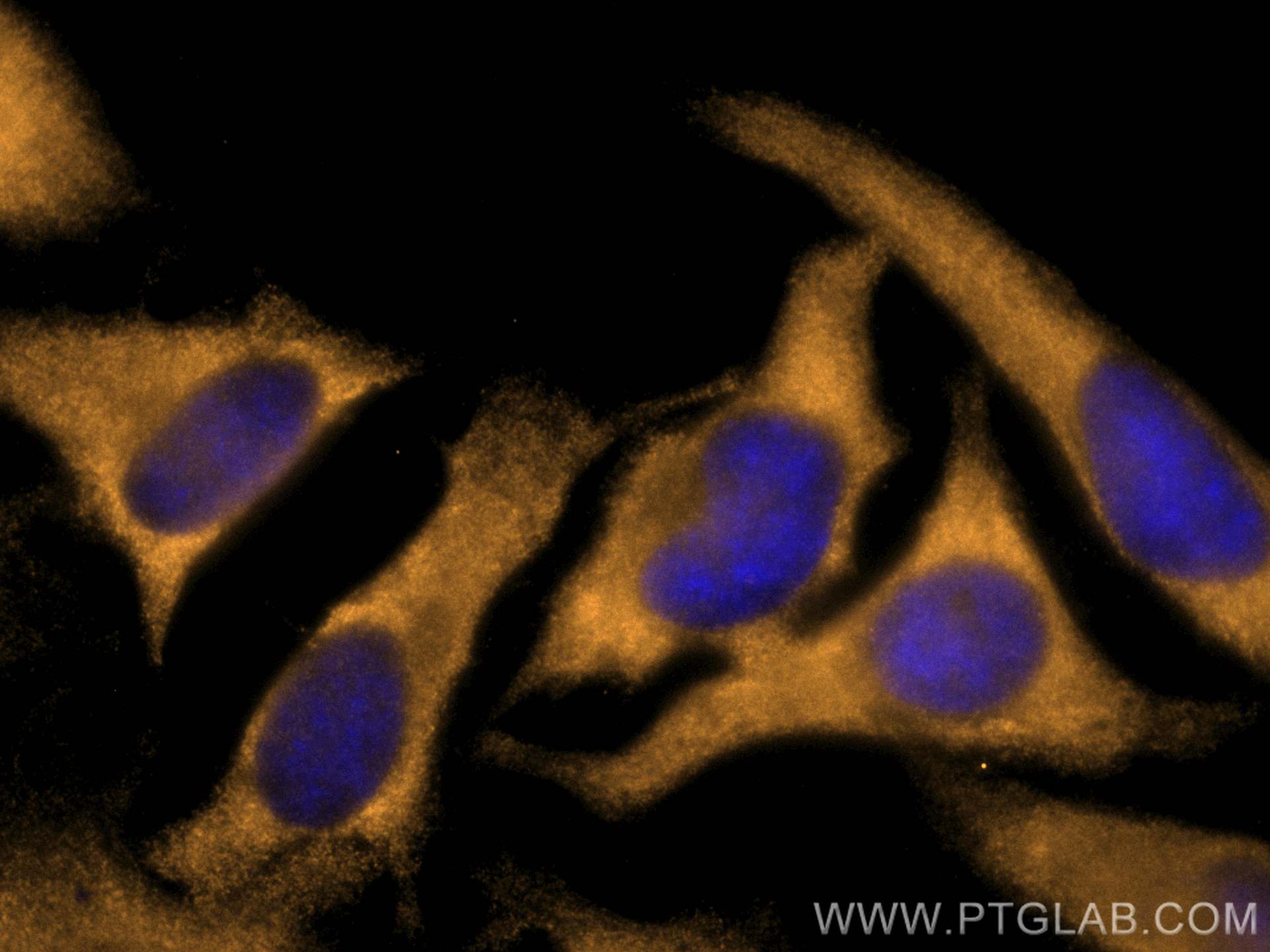 Immunofluorescence (IF) / fluorescent staining of HeLa cells using CoraLite®555-conjugated ACC1 Monoclonal antibody (CL555-67373)