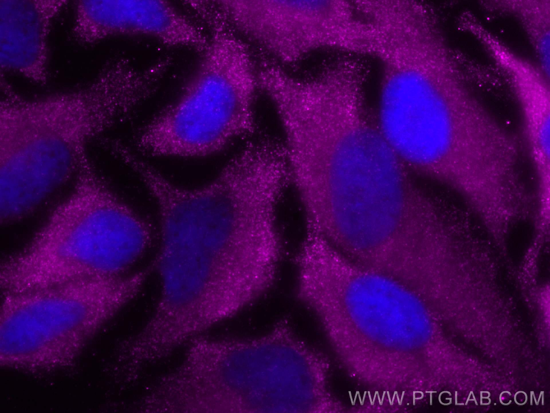 Immunofluorescence (IF) / fluorescent staining of HeLa cells using CoraLite® Plus 647-conjugated ACC1 Polyclonal anti (CL647-21923)