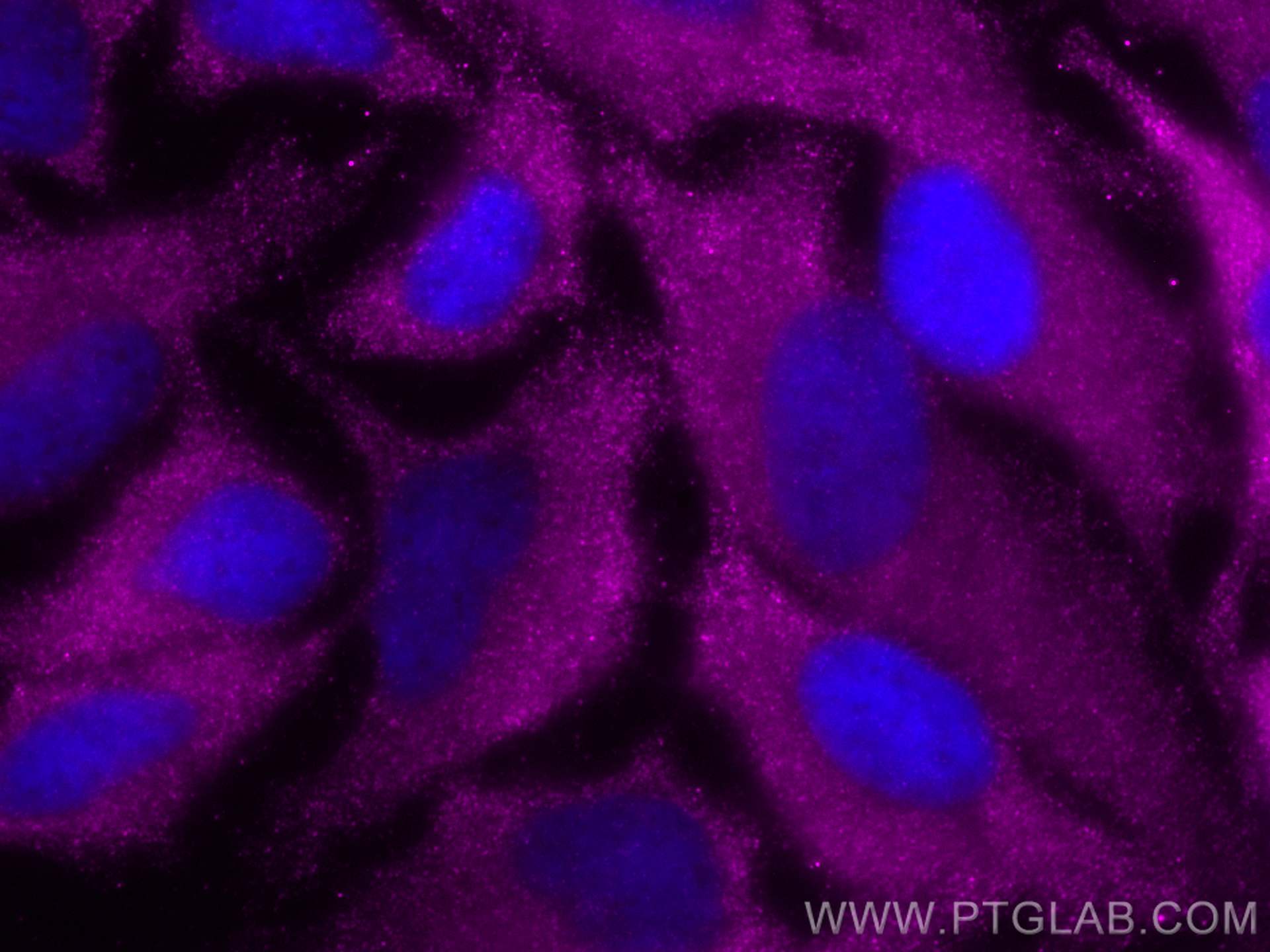 IF Staining of HeLa using CL647-21923