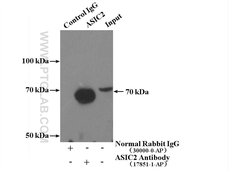Immunoprecipitation (IP) experiment of mouse brain tissue using ASIC2 Polyclonal antibody (17851-1-AP)