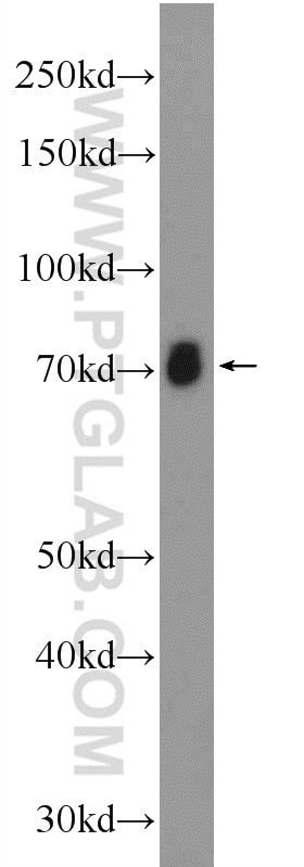 Western Blot (WB) analysis of rat brain tissue using ASIC2 Polyclonal antibody (17851-1-AP)