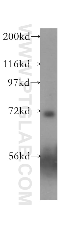 Western Blot (WB) analysis of A375 cells using ASIC4 Polyclonal antibody (12003-1-AP)