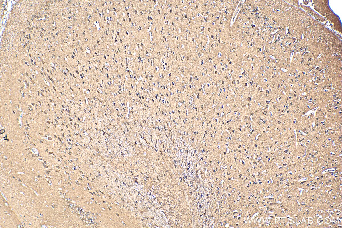 Immunohistochemistry (IHC) staining of mouse brain tissue using ACCN5 Polyclonal antibody (25356-1-AP)
